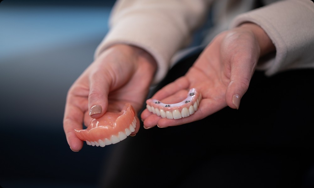 Dental Implants vs. Implant-Supported Dentures: Which Option Fits Your Smile and Budget? A Guide from All Smiles Dental